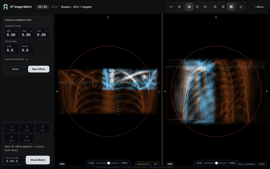 Breast L · SCV + Tangent — training image-matching screen