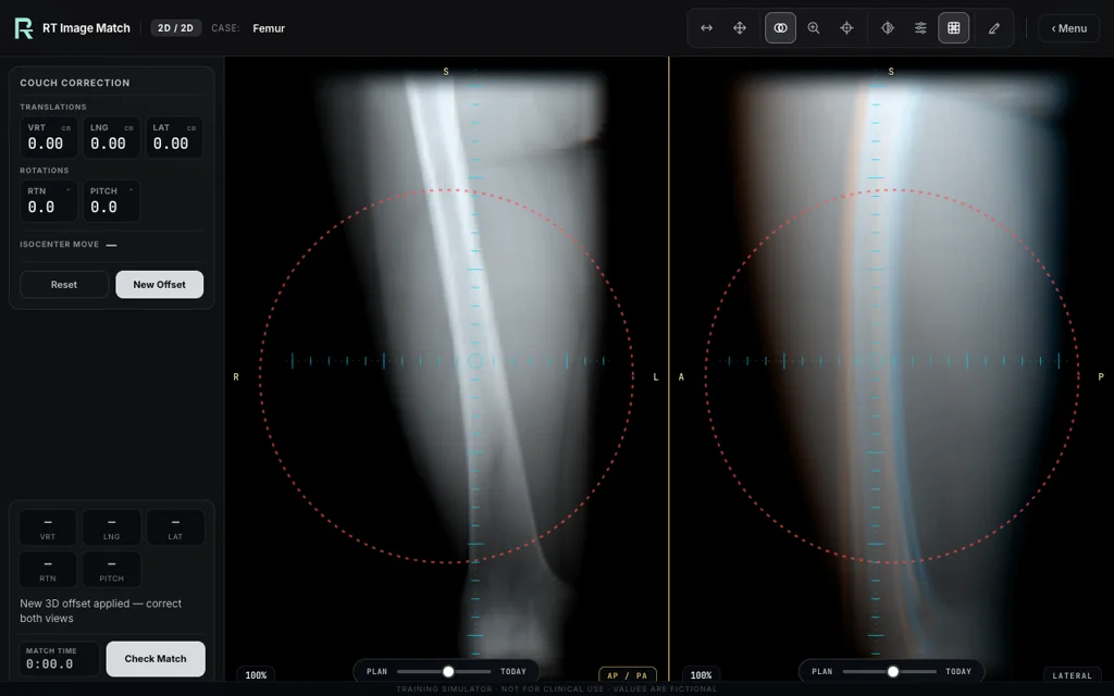 Femur — training image-matching screen