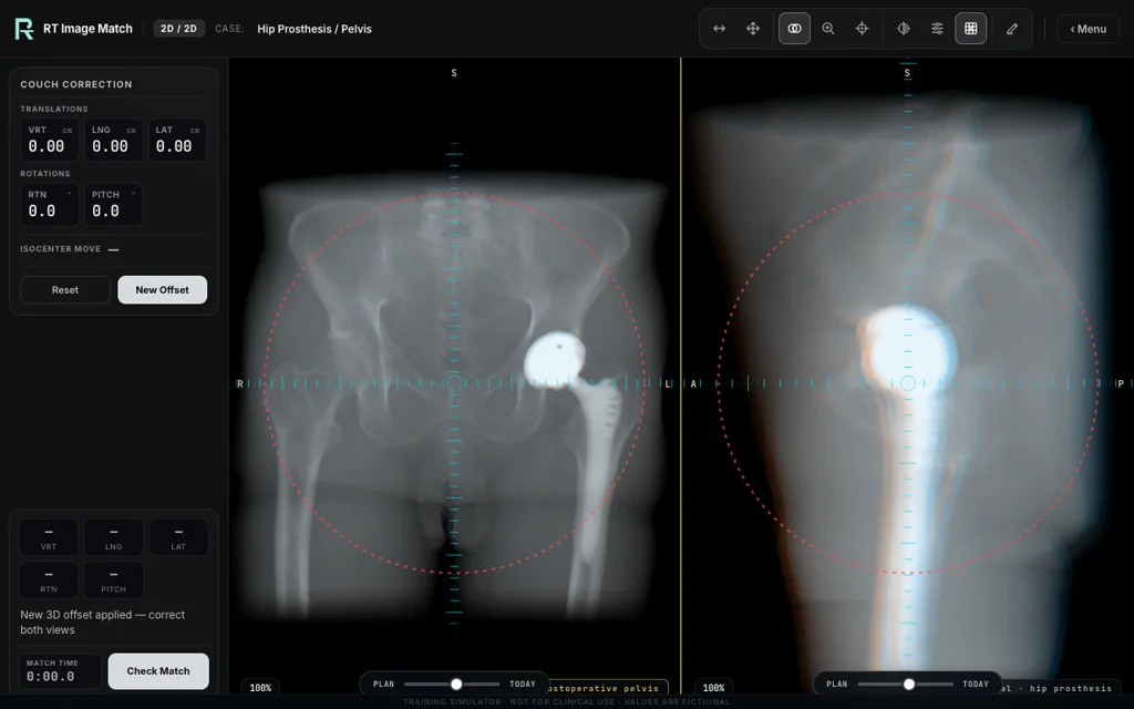 Hip Prosthesis / Pelvis — training image-matching screen