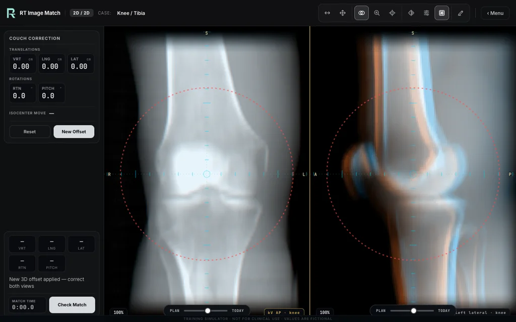 Knee / Tibia — training image-matching screen