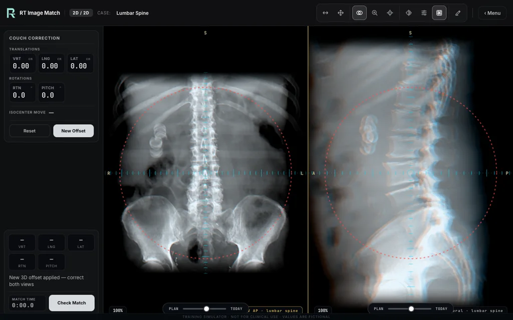 Lumbar Spine — training image-matching screen