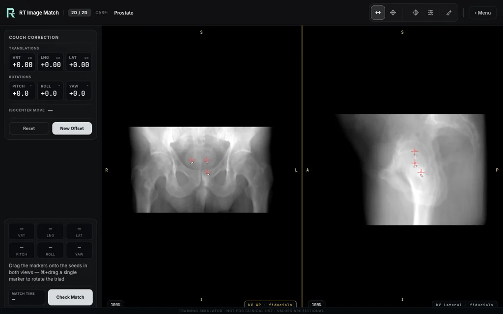 Prostate — training image-matching screen