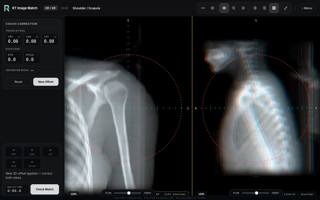 Shoulder / Scapula — training image-matching screen