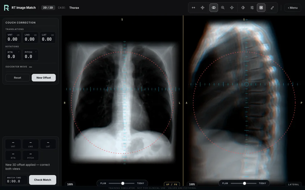 Thorax — training image-matching screen