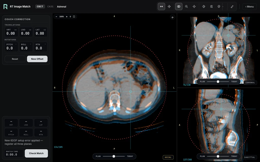 Adrenal — training image-matching screen