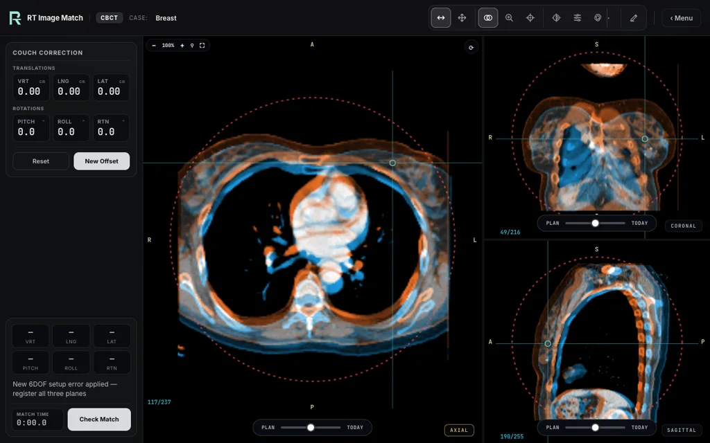 Breast — training image-matching screen