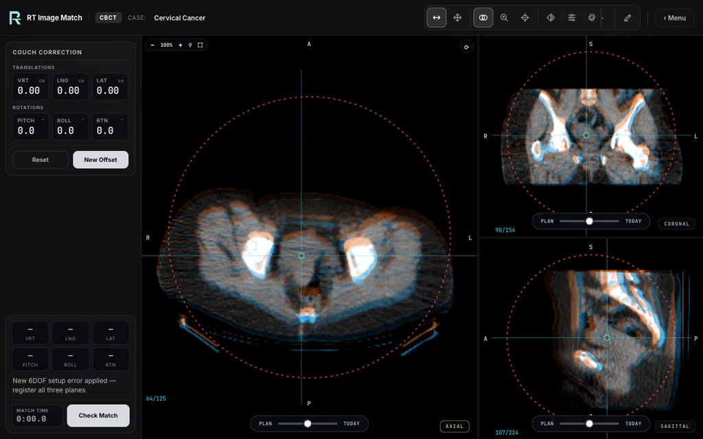 Cervical Cancer — training image-matching screen