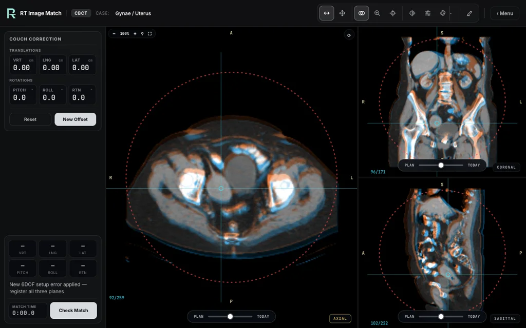 Gynae / Uterus — training image-matching screen