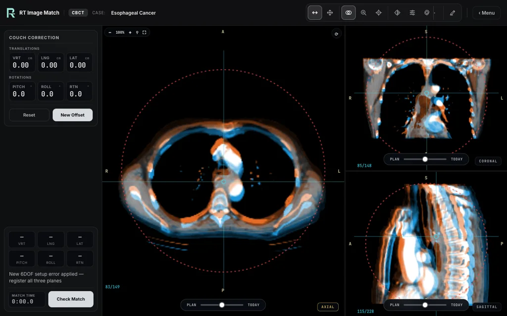 Esophageal Cancer — training image-matching screen