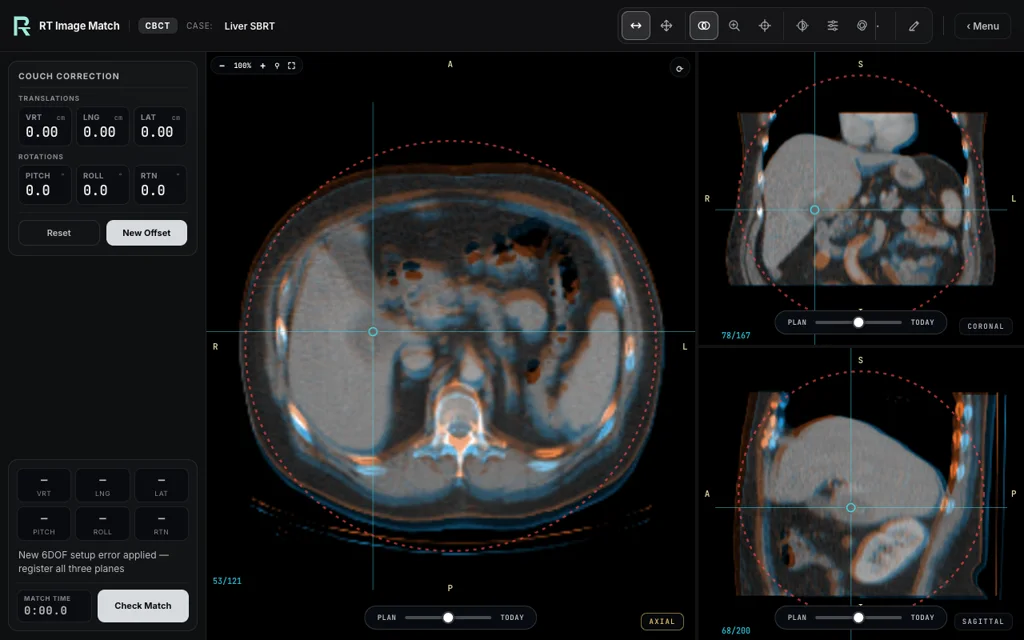 Liver SBRT — training image-matching screen