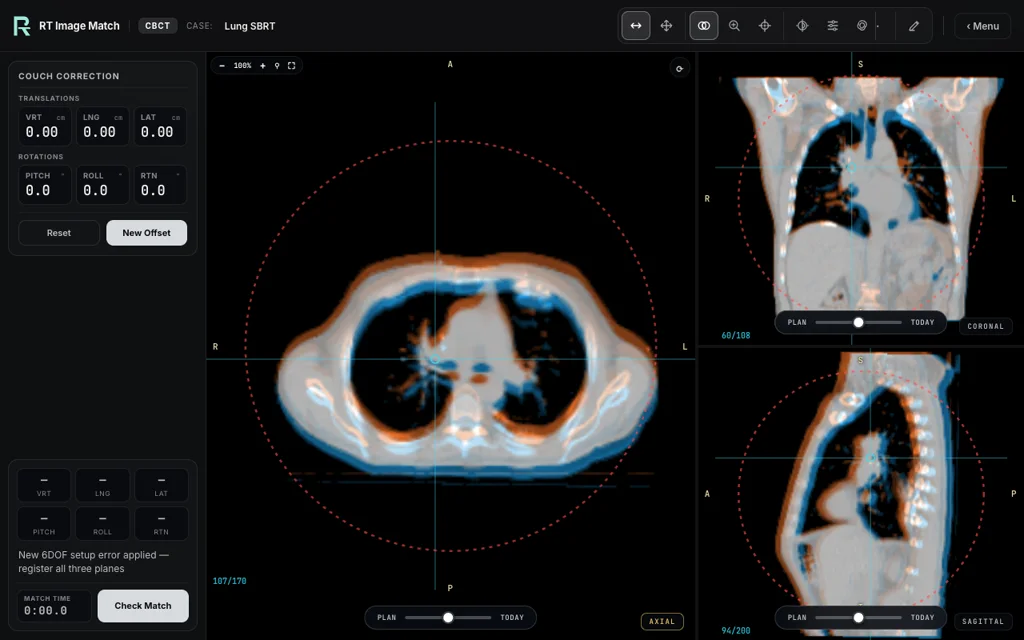 Lung SBRT — training image-matching screen