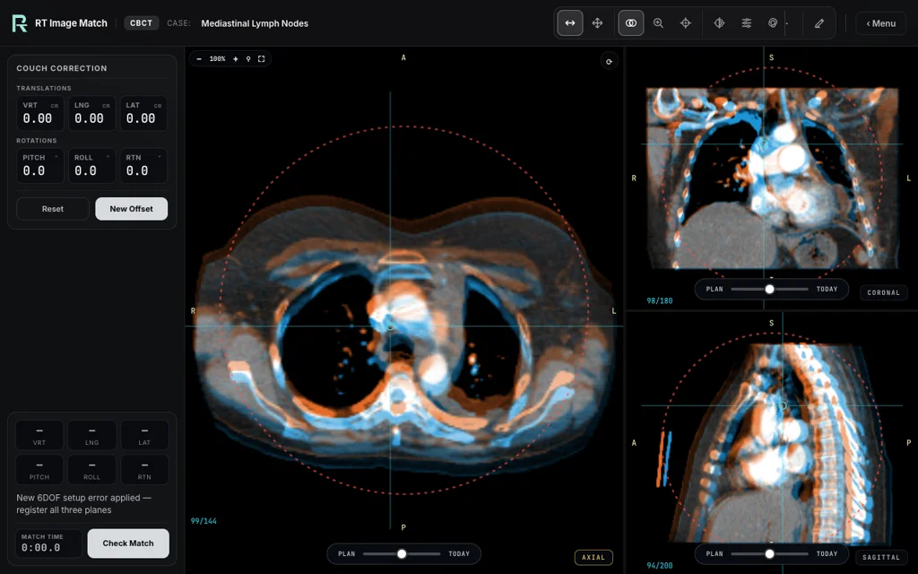 Mediastinal Lymph Nodes — training image-matching screen