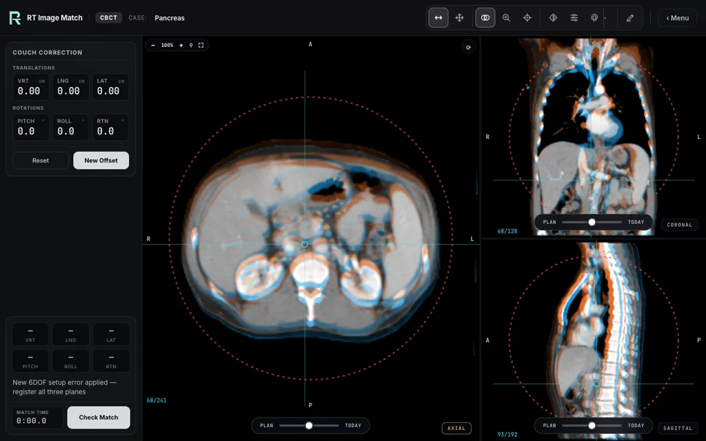 Pancreas — training image-matching screen