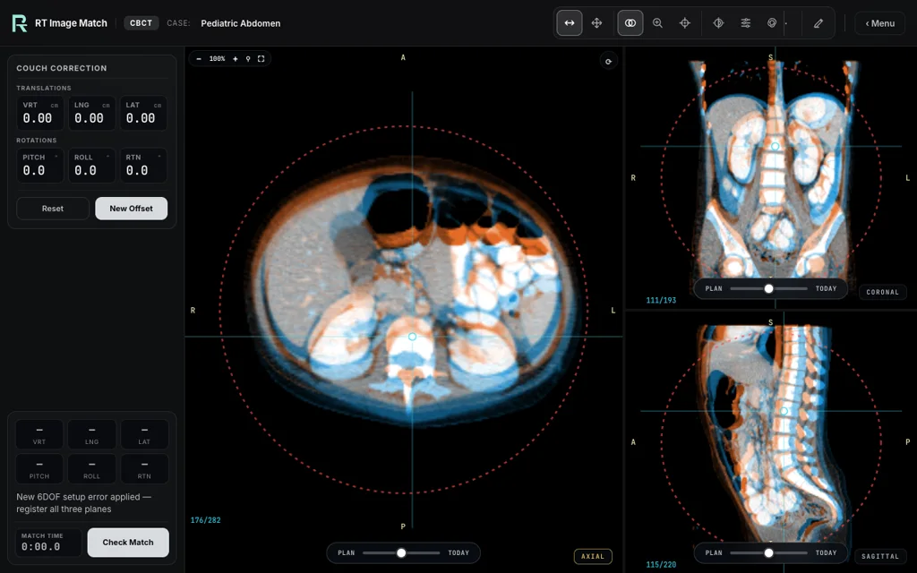 Pediatric Abdomen — training image-matching screen