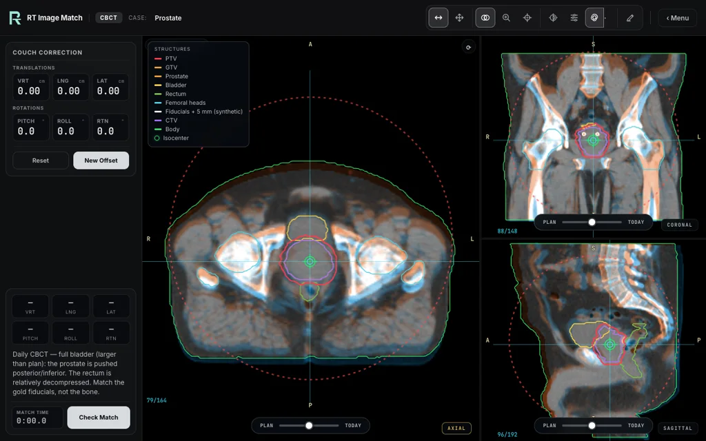 Prostate — training image-matching screen