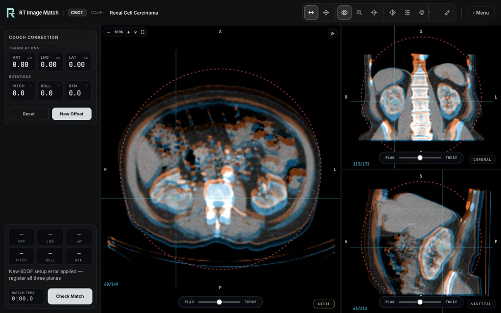 Renal Cell Carcinoma — training image-matching screen
