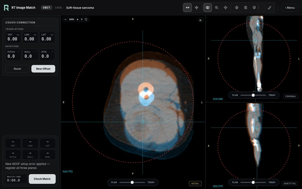 Soft-tissue sarcoma — training image-matching screen