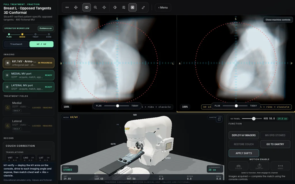 Breast L · Opposed Tangents 3D Conformal — Full Treatment image matching with linac view
