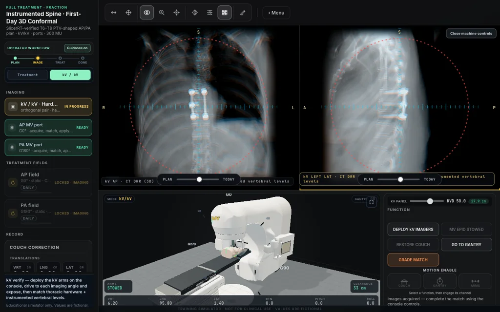 Instrumented Spine · First Day — Full Treatment image matching with linac view