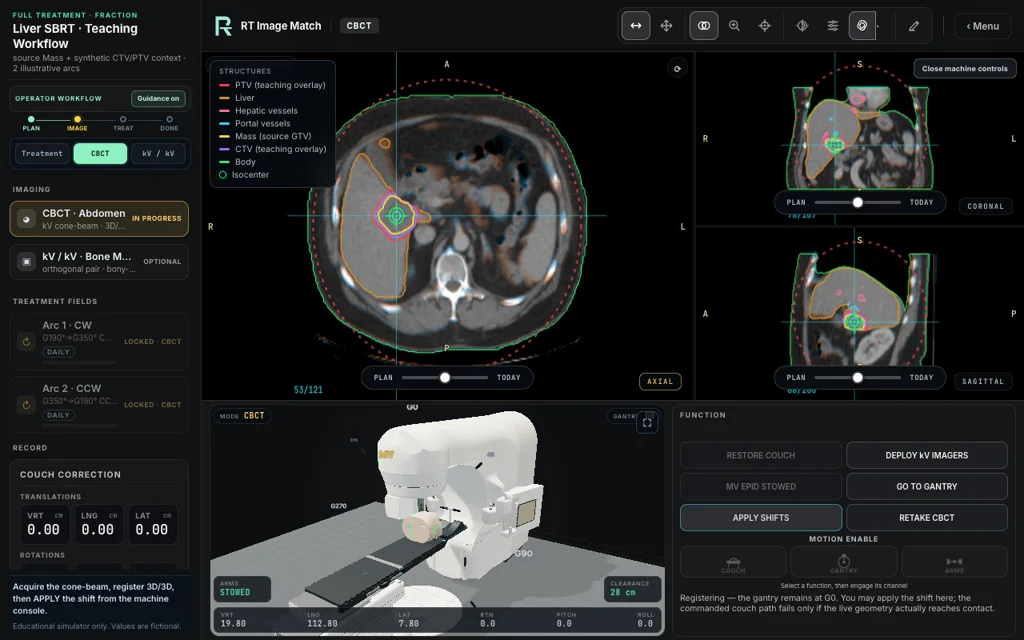 Liver SBRT · Teaching Workflow — Full Treatment image matching with linac view