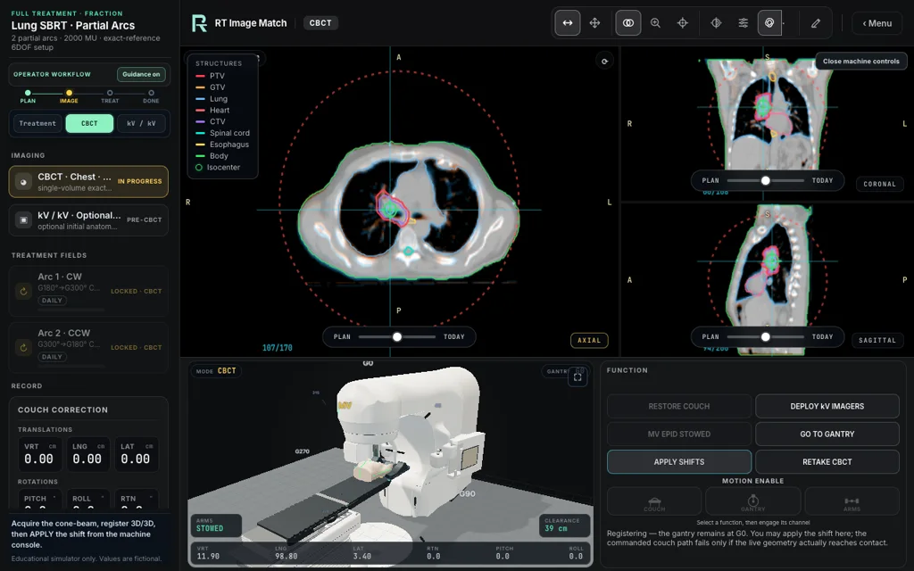 Lung SBRT · Partial Arcs — Full Treatment image matching with linac view