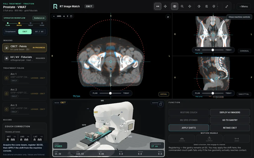 Prostate · VMAT — Full Treatment image matching with linac view