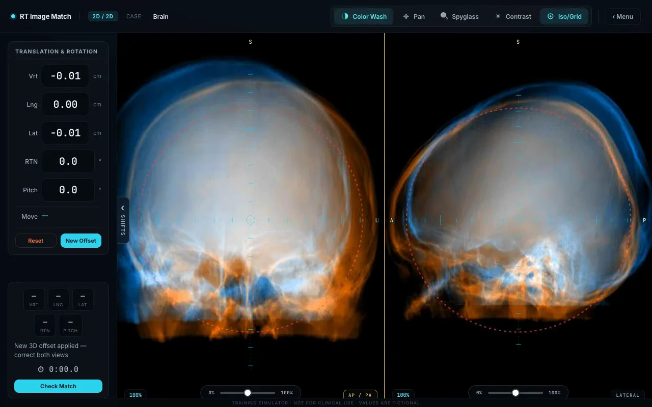 AP and lateral cranial images in the 2D/2D matching workspace