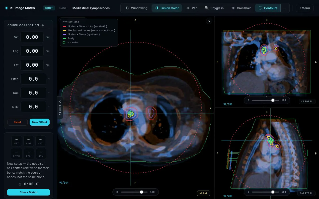 Three-plane CBCT registration workspace showing planning and daily mediastinal anatomy