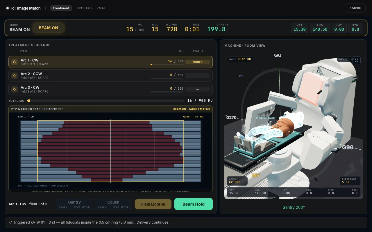 Full Treatment prostate workflow with CBCT, couch correction, and treatment controls