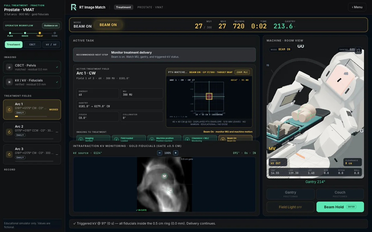 Recorded Full Treatment delivery with monitor-unit and gantry readouts above the rotating machine